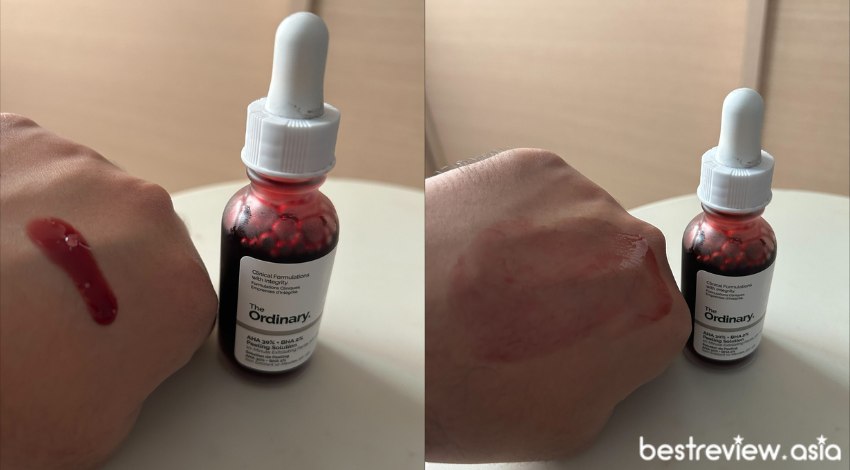 The Ordinary AHA30% + BHA2% Peeling ที่มีส่วนผสมของ AHA กับ BHA ที่ช่วยในการลดปัญหาสิว