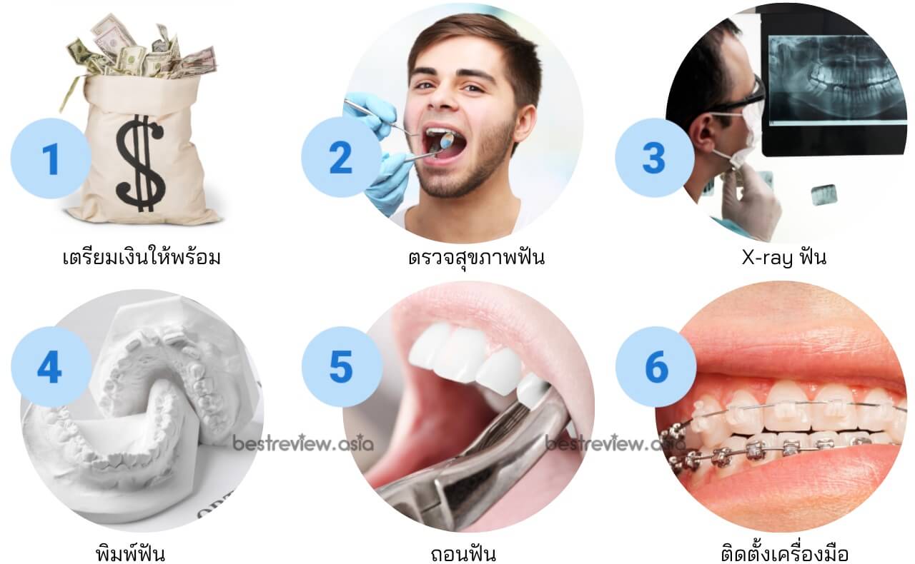 ต้องเตรียมตัวอย่างไรก่อนจัดฟัน
