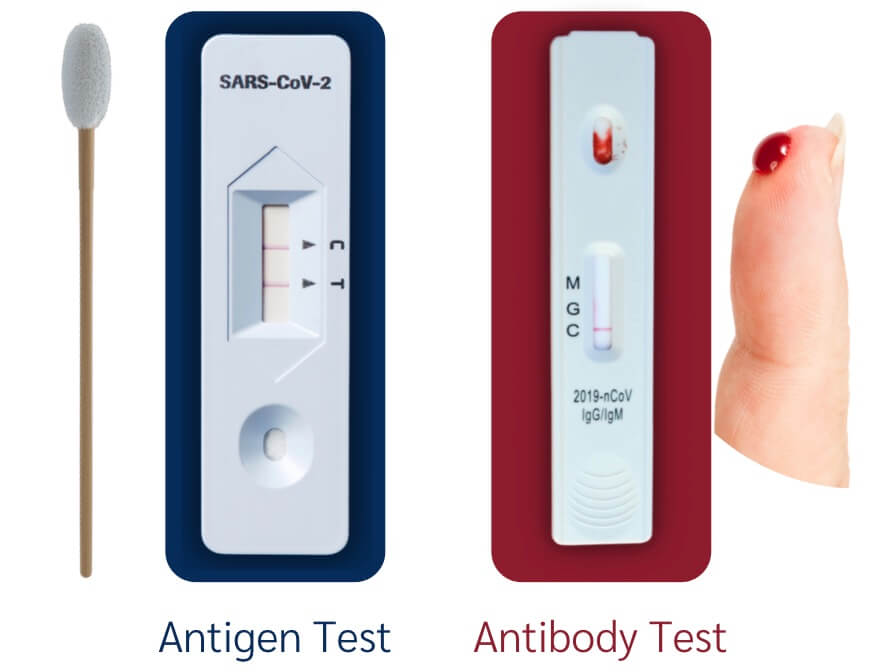 ชุดทดสอบแอนติเจน (Antigen Test) และ ชุดทดสอบแอนติบอดี (Antibody Test) ต่างกันอย่างไร