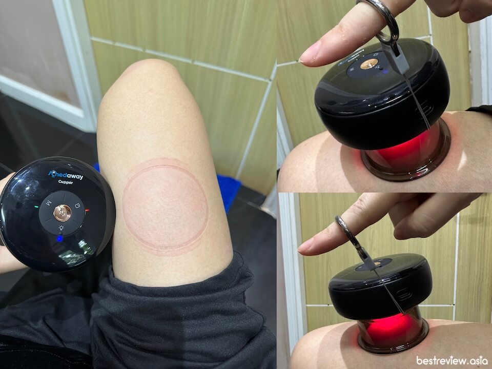 ผลลัพธ์หลังจากที่ทดลองใช้ เครื่องครอบแก้วอัจฉริยะ Achedaway Cupper